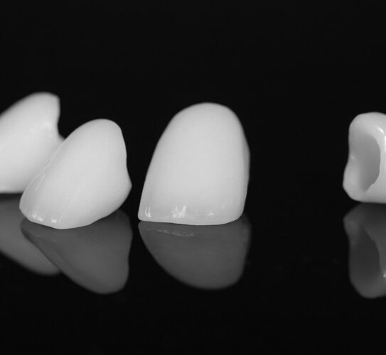Dental-Crowns