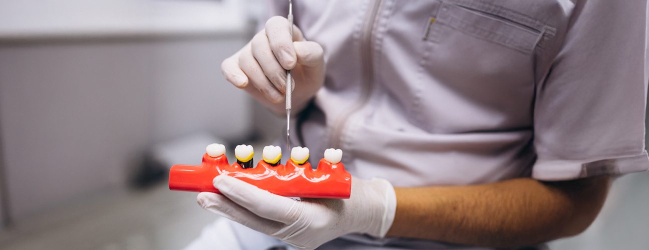 How to Fix a Sudden Gap Between Front Teeth in Adults