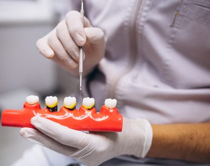 How to Fix a Sudden Gap Between Front Teeth in Adults