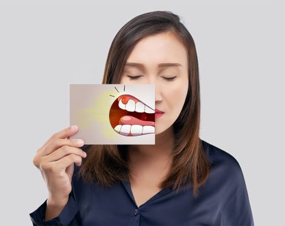 How to Recognize Irritated Gums Symptoms Early