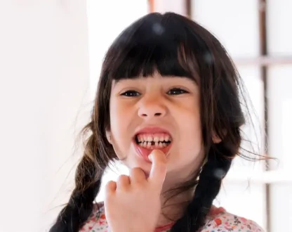 What to Do Immediately for a Broken Tooth with Exposed Pulp